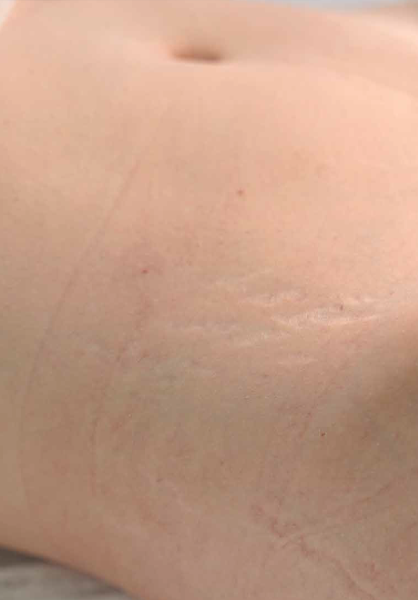 Результаты коррекции