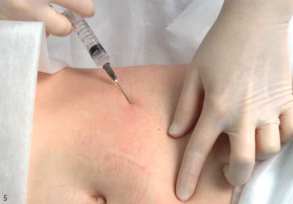 Процесс коррекции