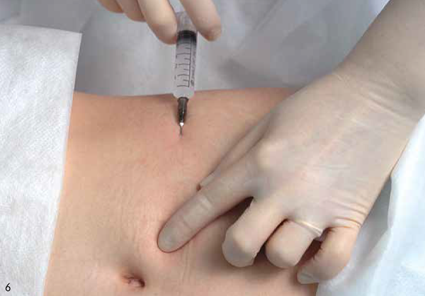 Процесс коррекции